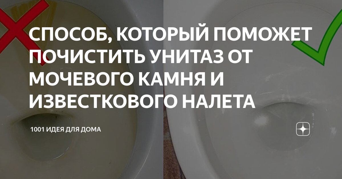 Очистка мочевого камня. Средство от известкового камня в унитазе. Очистить унитаз от известкового налета и мочевого камня. Мочевой камень под ободком унитаза.